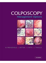 Colposcopy Management Options