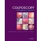 Colposcopy Management Options