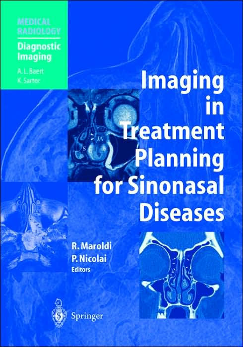 Imaging in Treatment Planning for Sinonasal Diseases