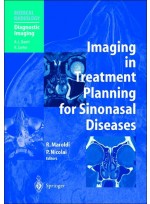 Imaging in Treatment Planning for Sinonasal Diseases