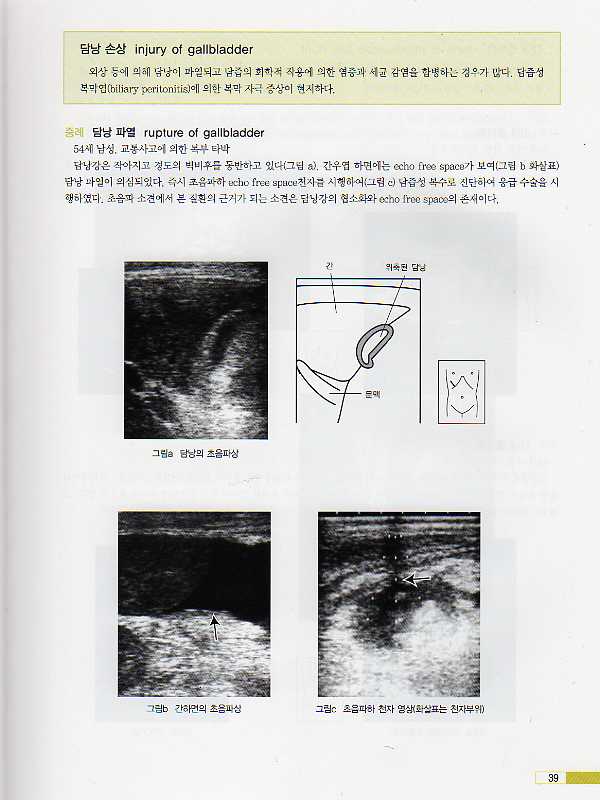 급성질환 및 응급질환 초음파검사 - 임상전과 영역에서