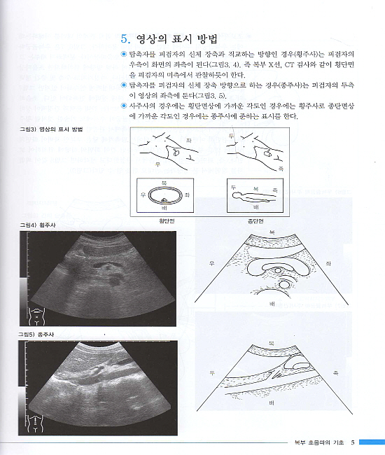 복부초음파14일 완성