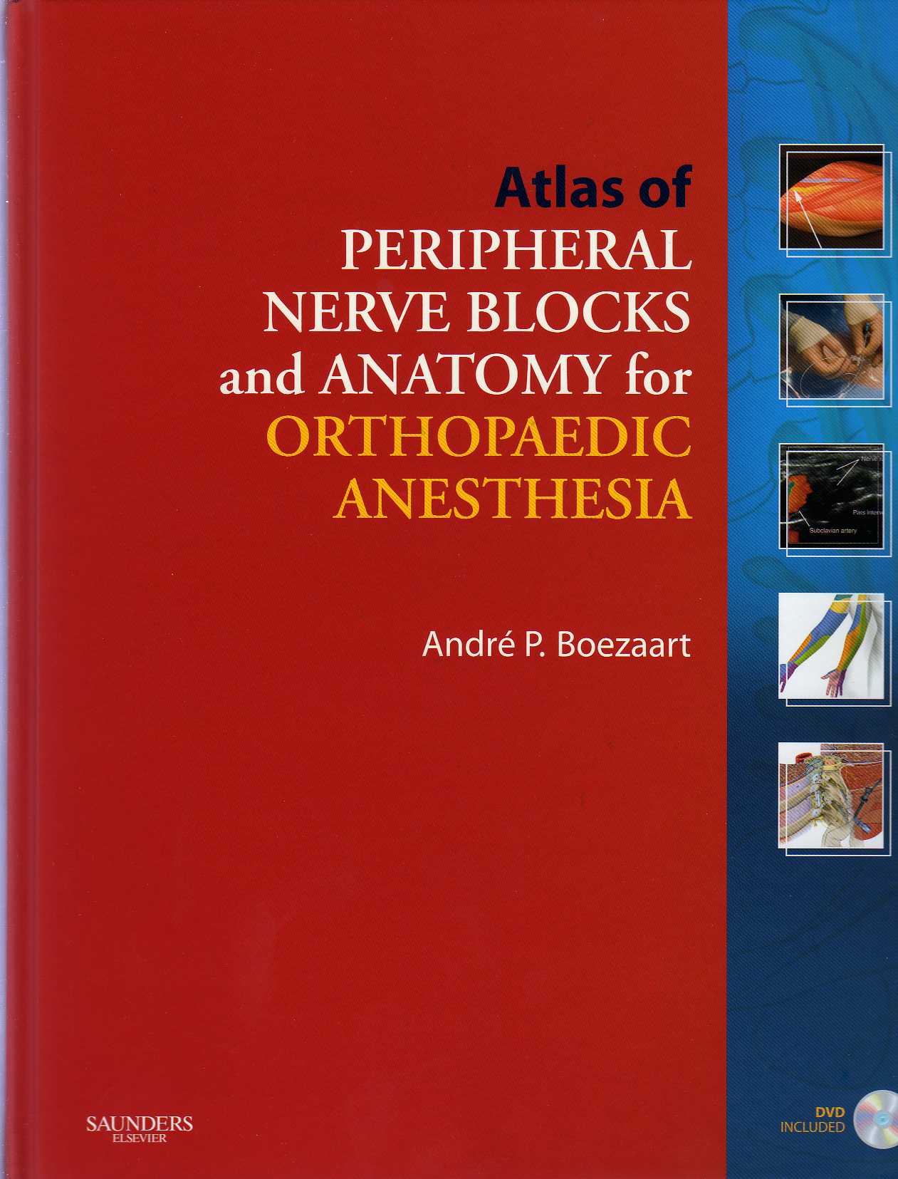 Atlas of Peripheral Nerve Blocks & Anatomy for Orthopedic Anesthesia with DVD