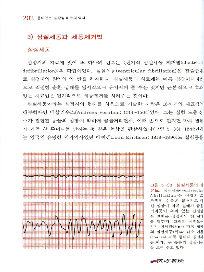 흥미있는 심장병 치료의 역사