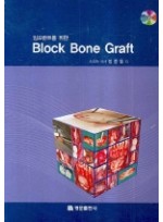 임프란트를 위한 | BLOCK BONE GRAFT (CD2포함)