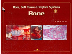 BONE SOFT TISSUE & IMPLANT SYSTEMS 1 -  BONE