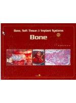 BONE SOFT TISSUE & IMPLANT SYSTEMS 1 -  BONE