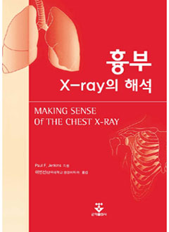 흉부X-ray의해석