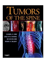 Tumors of the Spine