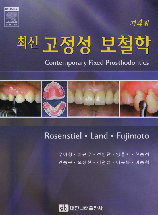 최신고정성보철학 (제4판)