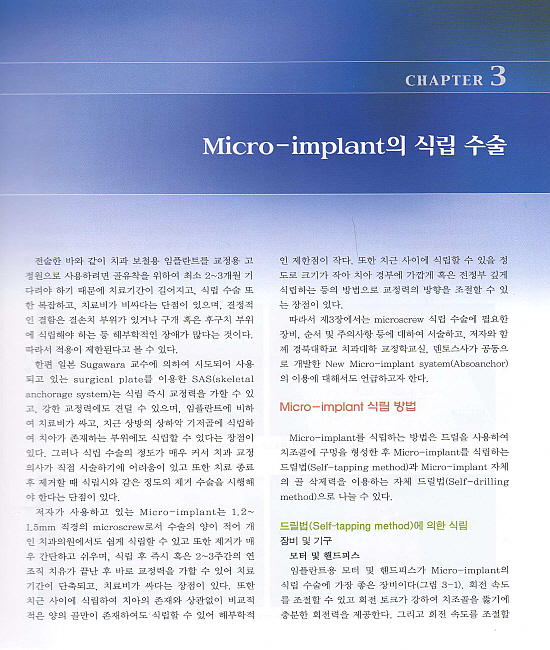 Micro-implant를 이용한 교정치료 (제2판)