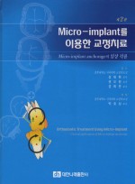 Micro-implant를 이용한 교정치료 (제2판)