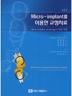 Micro-implant를 이용한 교정치료 (제2판)