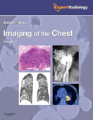 Imaging of the Chest