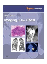 Imaging of the Chest