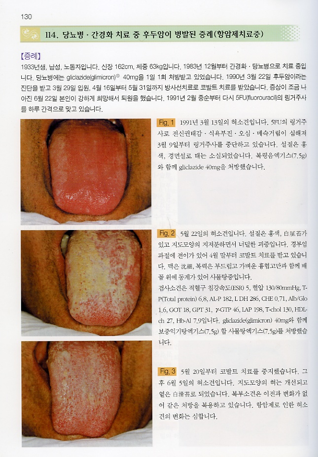 컬러 아틀라스 설진 임상증례집