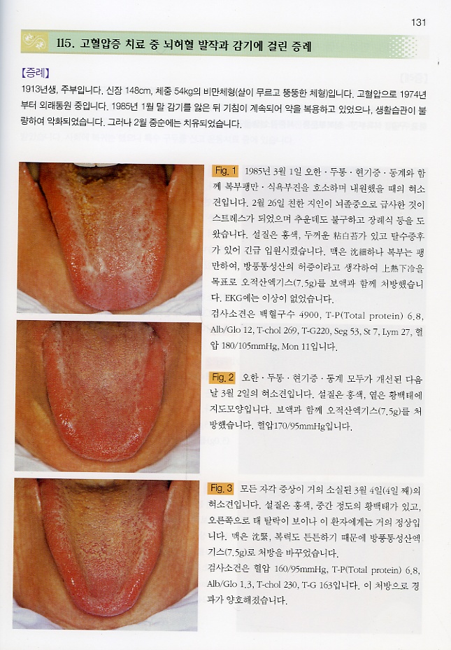 컬러 아틀라스 설진 임상증례집