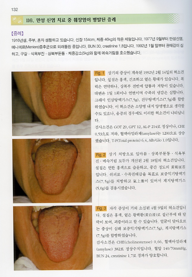 컬러 아틀라스 설진 임상증례집