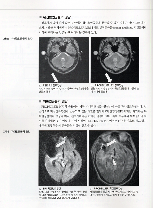 임상 MRI의 실제와 응용