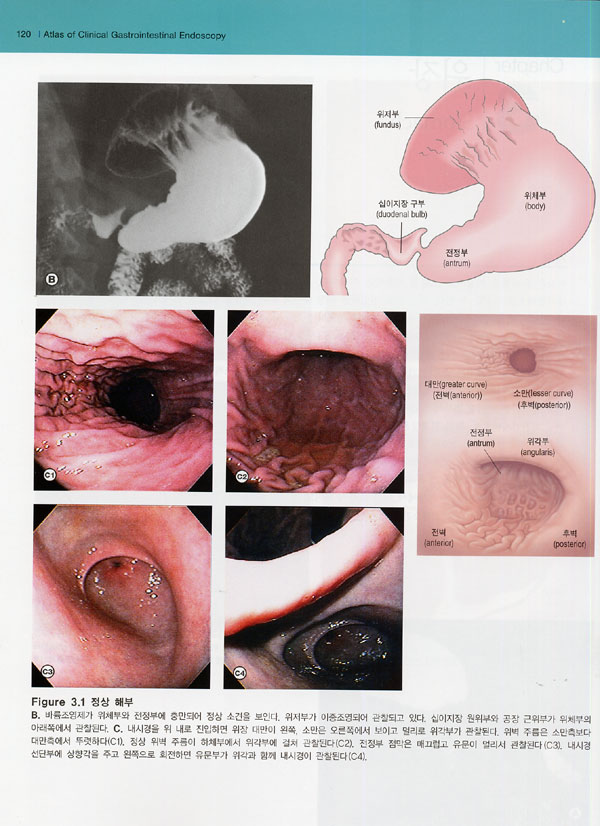 소화기 내시경 아틀라스 Atlas of Clinical Gastrointestinal Endoscopy /CD-ROM포함