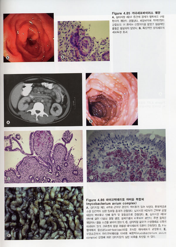 소화기 내시경 아틀라스 Atlas of Clinical Gastrointestinal Endoscopy /CD-ROM포함