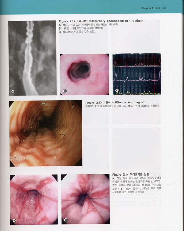 소화기 내시경 아틀라스 Atlas of Clinical Gastrointestinal Endoscopy /CD-ROM포함