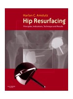 Hip Resurfacing: Principles,Indications,Technique & Results