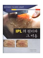 IPL의 원리와 그 이용