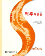 척추측만증 (영창)