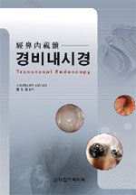 경비내시경 Transnasal Endoscopy