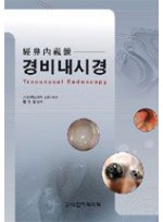 경비내시경 Transnasal Endoscopy