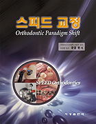 스피드 교정 - Orthodontic Paradigm Shift -