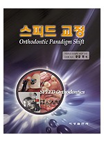 스피드 교정 - Orthodontic Paradigm Shift -