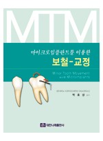 마이크로임플란트를 이용한 보철-교정