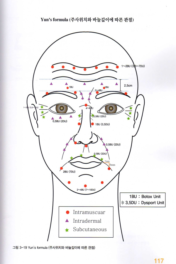보톡스 임상적 사용, 3/e