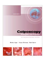 Colposcopy,2/e: Principles & Practice (Text with DVD)