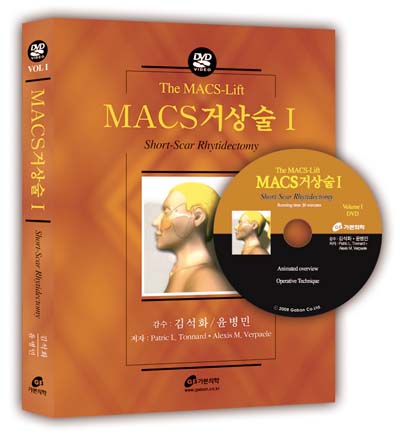 MACS 거상술 I