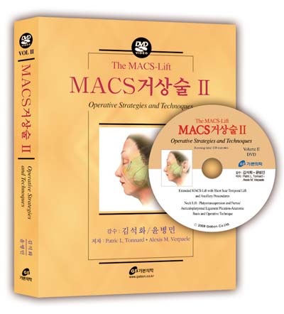 MACS 거상술 II