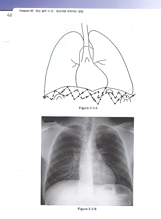 Felson의 흉부방사선학 원리 - A Programmed Text, Third Edition