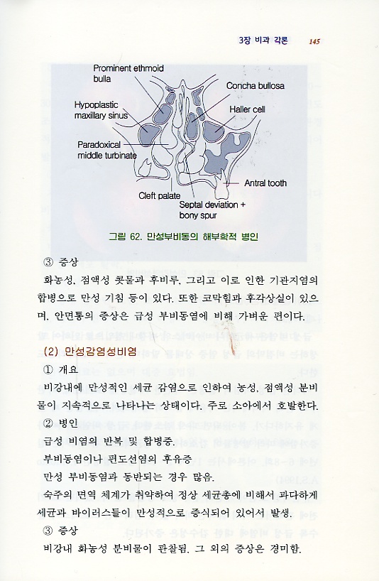 한방비내시경학