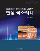 Valplast system을 이용한 탄성 국소의치