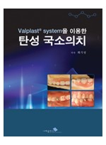 Valplast system을 이용한 탄성 국소의치