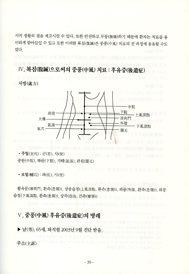 복침요법 ( 腹鍼療法 )