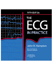 The ECG In Practice,5/e