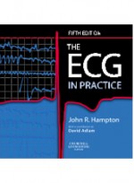 The ECG In Practice,5/e