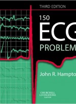 150 ECG Problems, 3/e