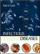 Infectious Diseases