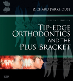 Tip-Edge Orthodontics and the Plus Bracket, 2nd Edition