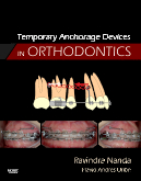 Temporary Anchorage Devices in Orthodontics