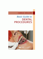 Basic Guide to Dental Procedures